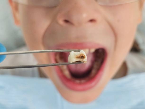 Best After-Hours Emergency Dentist in Mount Zion, IL